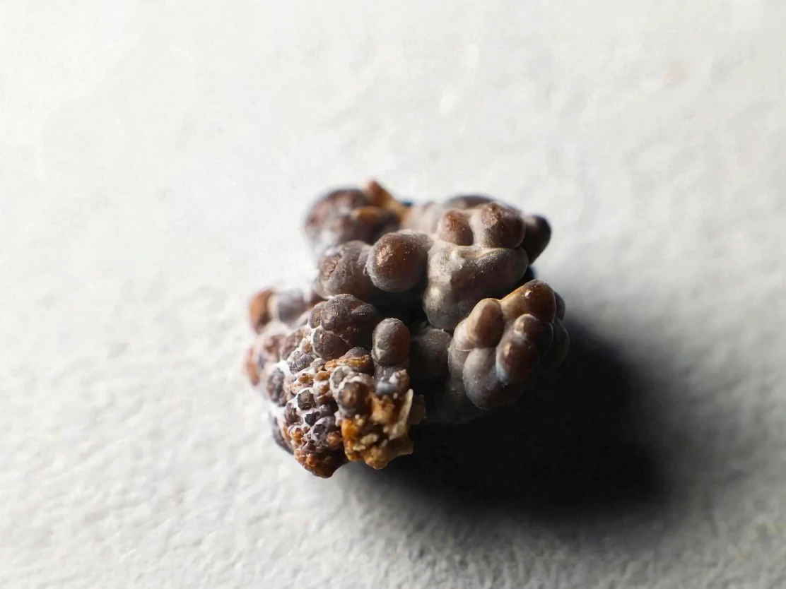 Imagem macro de um cálculo urinário de superfície irregular sobre fundo claro